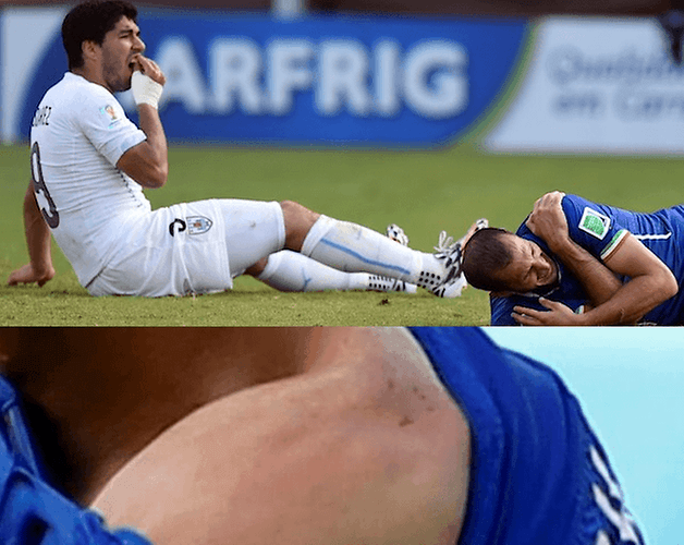 suarez 01