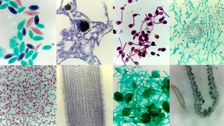 Nurugo microscope 02