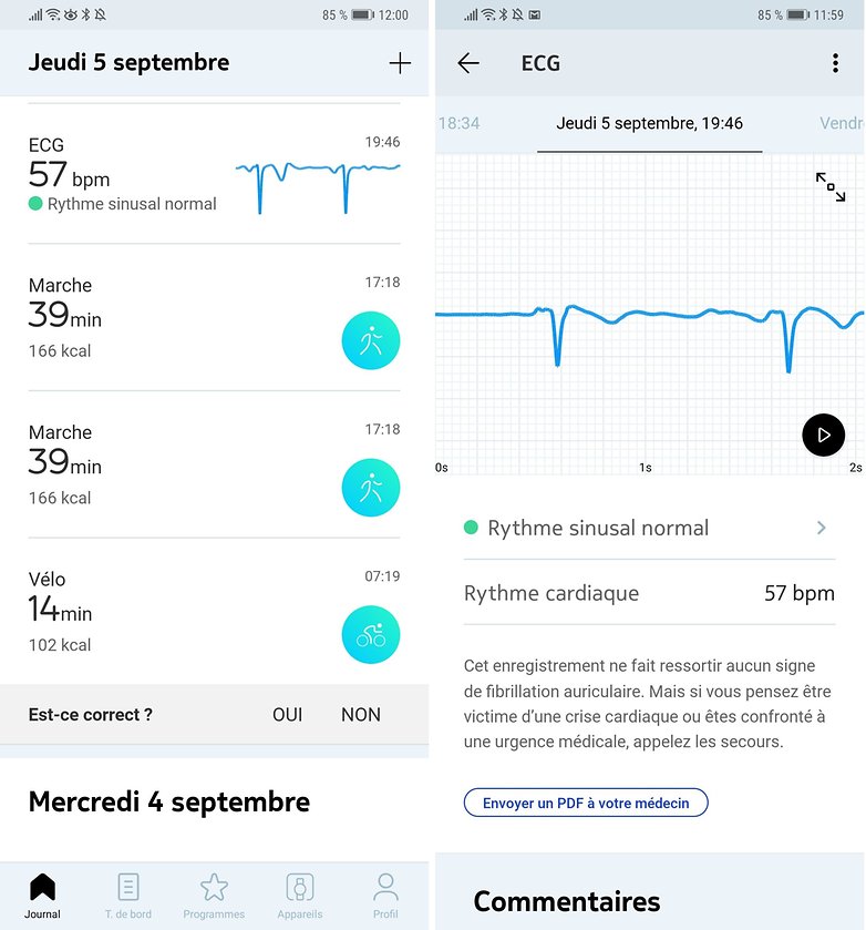 androidpit withings app ecg