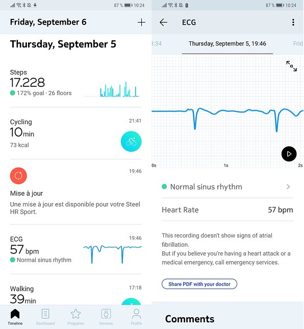 withings ecg release date
